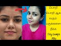 How To Get Rid Of Milia Tiny Bumps Naturally Home Remedy For Tiny Bumps Milia At Home In Tamil