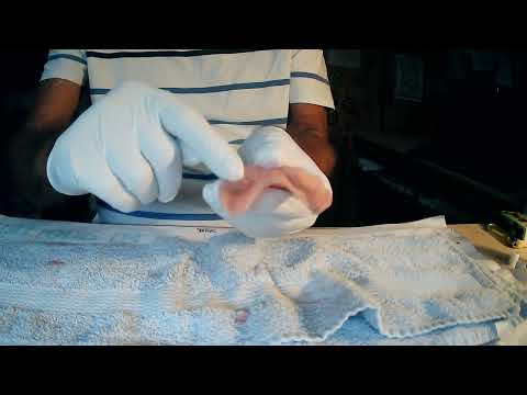 Zahnprothese kein Problem, Teil 3b, unterfüttern