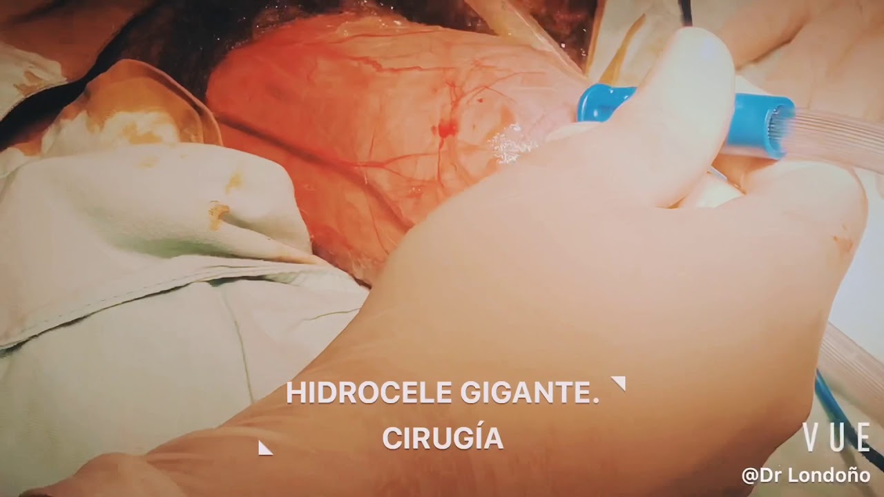 Carlos Londoño Martínez-34