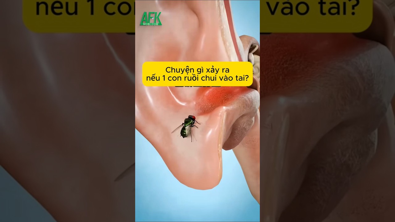 Chuyện gì xảy ra nếu 1 con ruồi chui vào tai bạn?