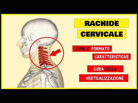 Dolore addominale che si estende alla parte superiore della schiena Ginnastica per il collo con osteocondrosi cervicale
