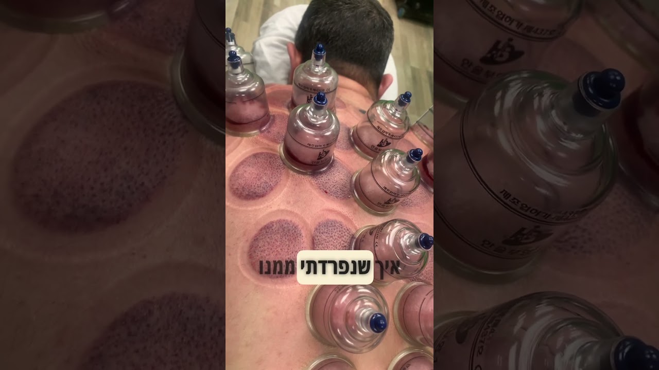 כוסות רוח לספורטאים צביקה שנקר 050-8776451