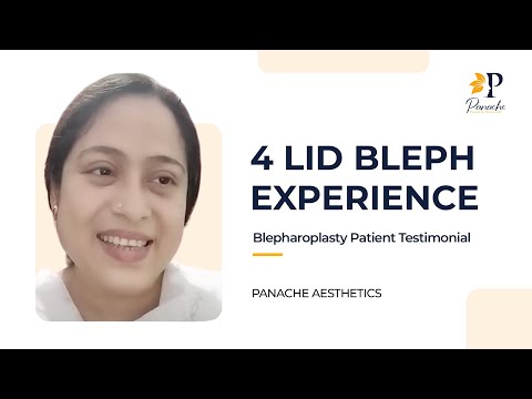 Blepharoplasty Testimonial