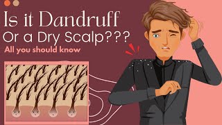 Is It Dandruff Or A Dry Scalp? Here