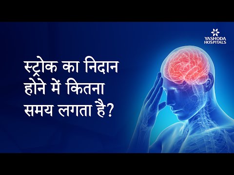 स्ट्रोक का निदान होने में कितना समय लगता है?