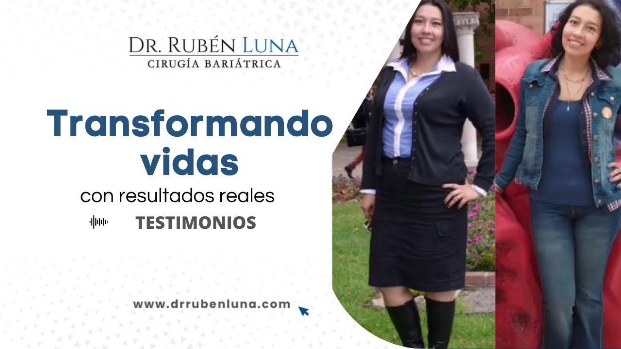 Testimonio de Cirugía Bariátrica | Video antes y después de Cirugía Bariátrica | Dr Rubén Luna.