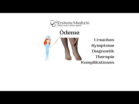 Ödem