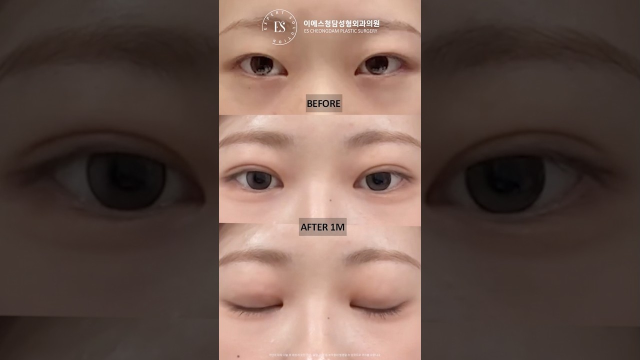 이에스 유튜브