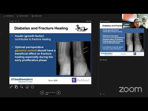 Ankle Fractures in Diabetics
