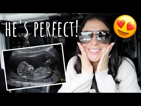 seeing baby boy for the second time! 13 week ultrasound😍