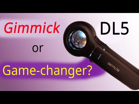 Dermlite DL5 : Gimmick or Game-Changer? Full review