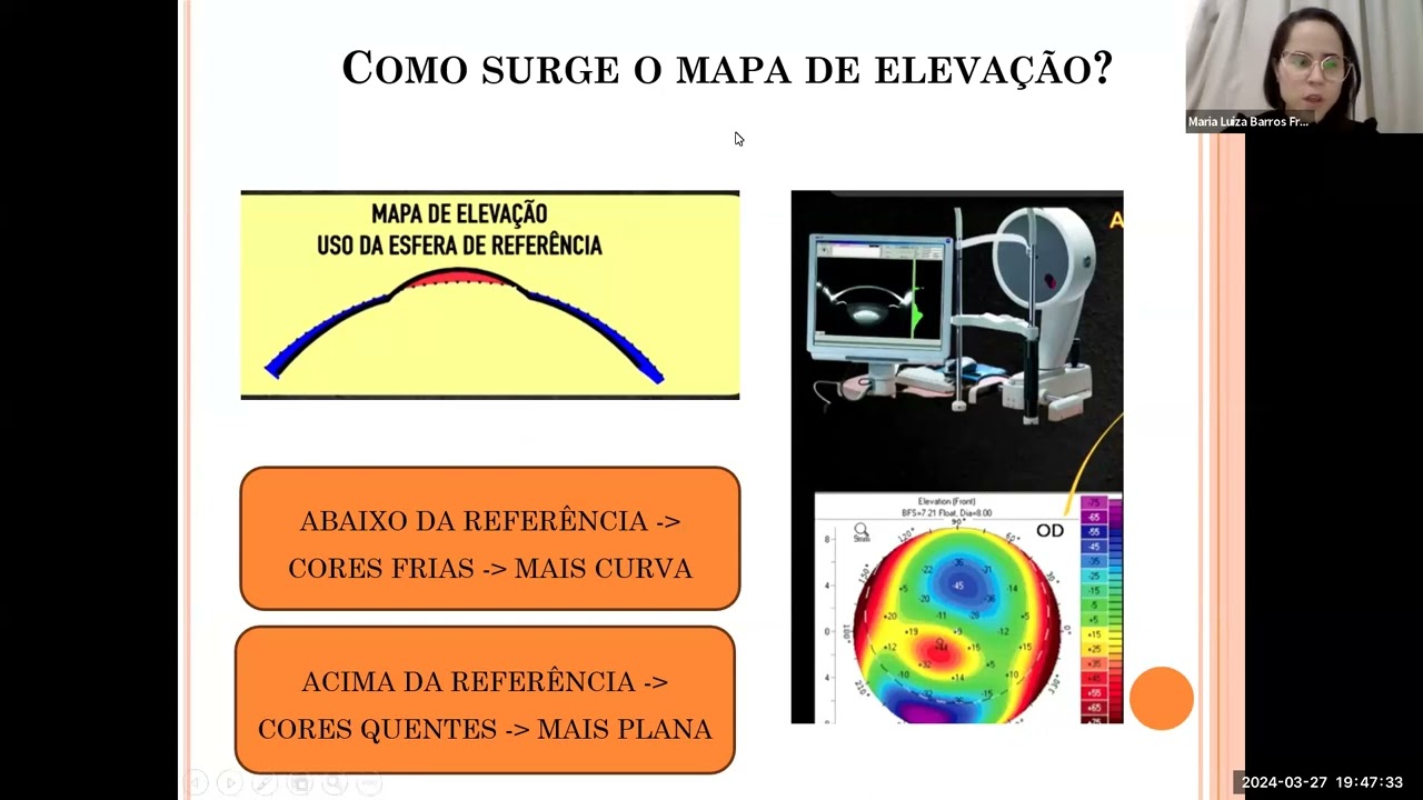 TOMOGRAFIA DE CORNEA, OCT CORNEA E MAPA EPITELIAL