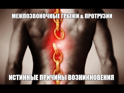 Лечения позвоночника по методу бубновского Компрессионный перелом седьмого позвонка грудного отдела