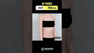 겨울 옷 핏, 팔에서 갈림 🥼