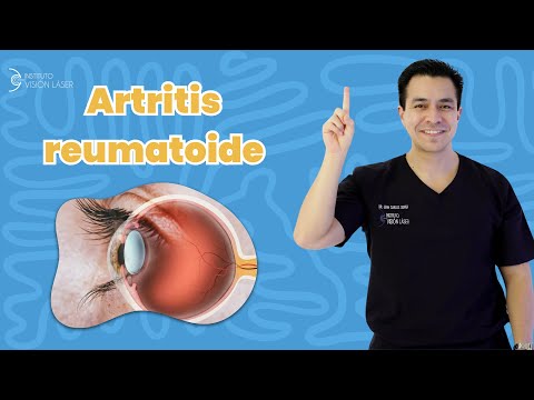 Artritis Reumatoide y los Ojos