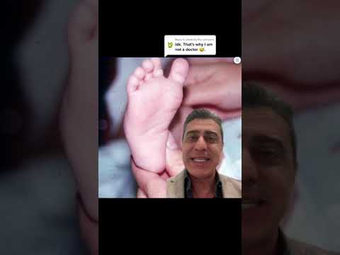 Long leg cast answer reveal
