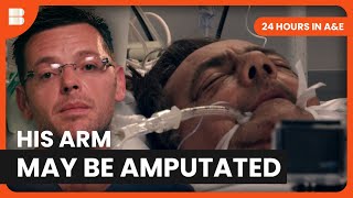 His Right Arm May Need To Be Amputated | 24 Hours in A&E | Medical Documentary