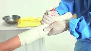 HM SPLINT (Orthopedic Splint) youtube video