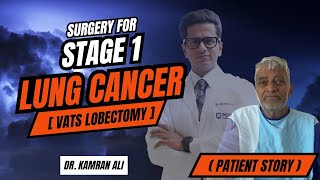 Lung Cancer Stage 1 Surgery - VATS Lobectomy