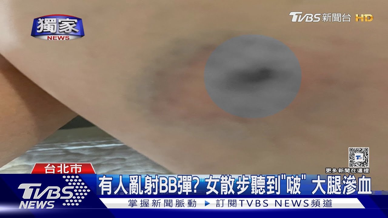 有人亂射BB彈？女散步聽到「啵」大腿滲血