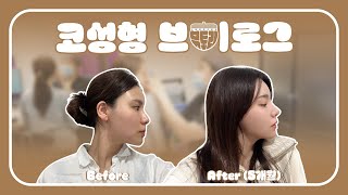 코수술 브이로그 수술 직후부터 6개월 후기까지ㅣ 뷰티스토리 ㅣ김형석 성형외과 전문의