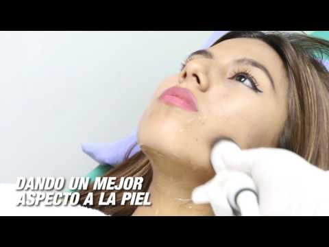 Radiofrecuencia Facial