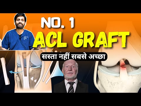 Best Graft for ACL Surgery | Types of ACL Grafts Explained & How to Choose