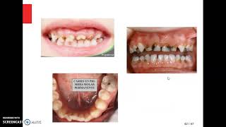 Salud bucal (Parte 1)