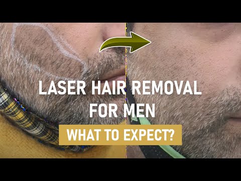 Laser Hair Removal for Men- Purpose, Benefits, Results...