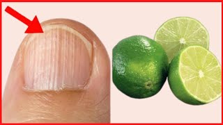 Top 3 Natural Home Remedies for Black Lines on Nails| How to get rid of ridges in fingernails