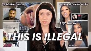 "$150 Braces" 'BracesTechs' of Tiktok! *this is ILLEGAL*