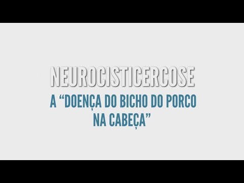 , title : 'Verme do porco na Cabeça. Neurologista Saulo Nader explica Neurocisticercose'