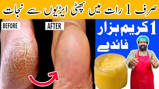 Remove Cracked Heels In Over Night | Get Beautiful Feet Permanently | White & Smooth Feet |BaBa Food