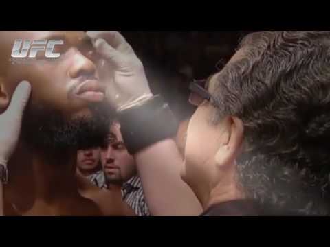 Jon Jones vs Vitor Belfort UFC 152  UFC Full Fight 2017