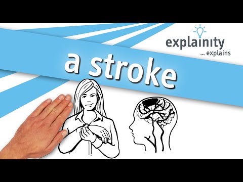 Stroke – explained simply