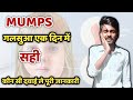 Mumps Treatment | गलसुआ | Galsua Hone Par Kya Karna Chahiye?🙄 2023