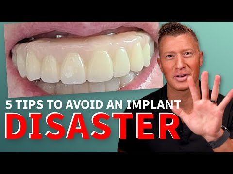 5 Tips to ESCAPE DISASTER with your All-on-4 Smile, All-on-6, Full Mouth Dental Implant Smile