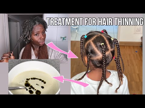 , title : 'How To Make Hair Treatment For Thinning Hair! Aloe Vera gel, Honey, yogurt & Banana Hair Mask| #mask'