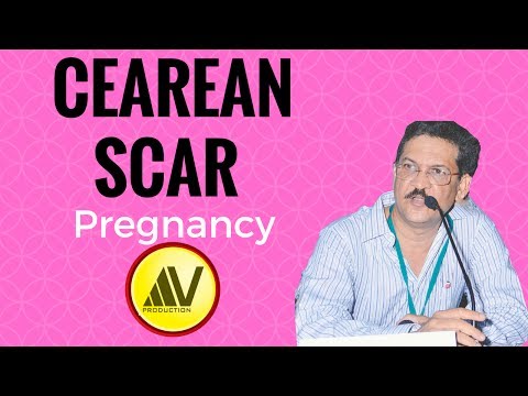 Slimming para sa mga tamad-free Kailangan mong gawin upang lumago manipis na tiyan