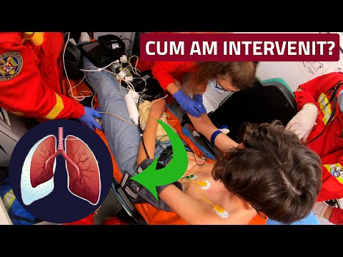 Lipsa de aer in statia de autobuz (pacient tanar) - De garda pe SMURD