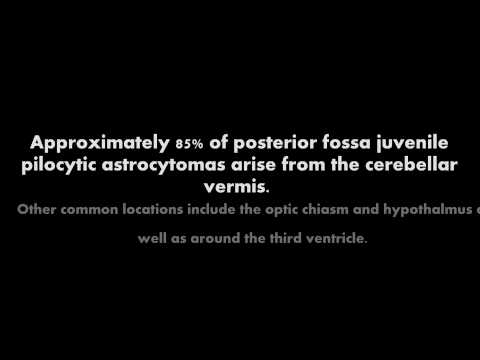 Neuroradiology Teaching Case 76