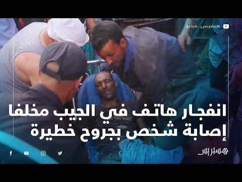 هاتف يتسبب في انفجار قنينة للكربون داخل محل للصيانة في بني ملال مخلفا إصابة شخص بجروح خطيرة