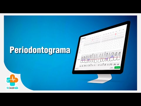 Periodontograma | Tu Salud Guía