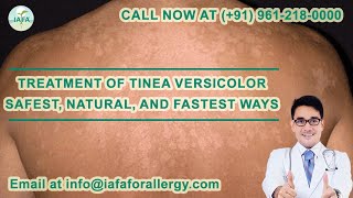 Treatment of Tinea Versicolor - Safest, Natural, and Fastest Ways