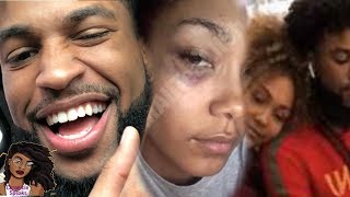 Parker McKenna&#39;s Family Upset After She Get&#39;s Black Eye After Chris Sail&#39;s Breakup