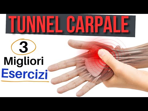 Tunnel Carpale: i 3 Migliori Esercizi