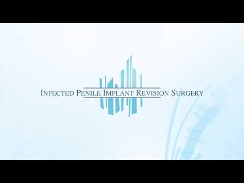 Infected Penile Implant Revision Operation 