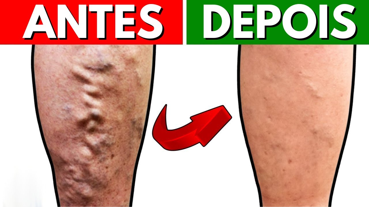 As 5 melhores bebidas para melhorar a circulação sanguínea