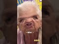 They dilated the eyes 👀 😂 #dilatedtheeyes #lol #funny #repost #grandma #oldlady #sofunny #reshare