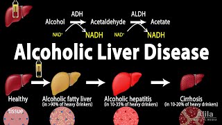 Alcoholic Liver Disease Animation